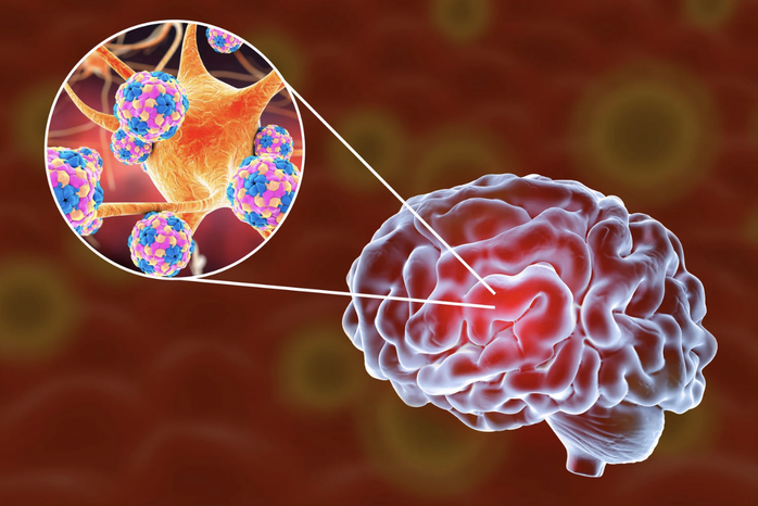 Báo Người Lao Động tổ chức talkshow: “Sự nguy hiểm của viêm màng não: Phát hiện, điều trị ra sao?